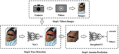 Prediction of anemia using facial images and deep learning technology in the emergency department